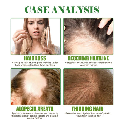 Rosemary Hair Care Oil for growth and prosperity